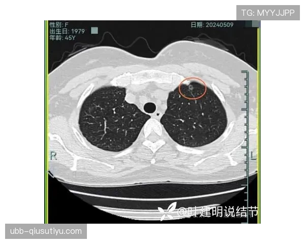 莱万多夫斯基高位压迫下的转移与终结节奏为何出现分化？